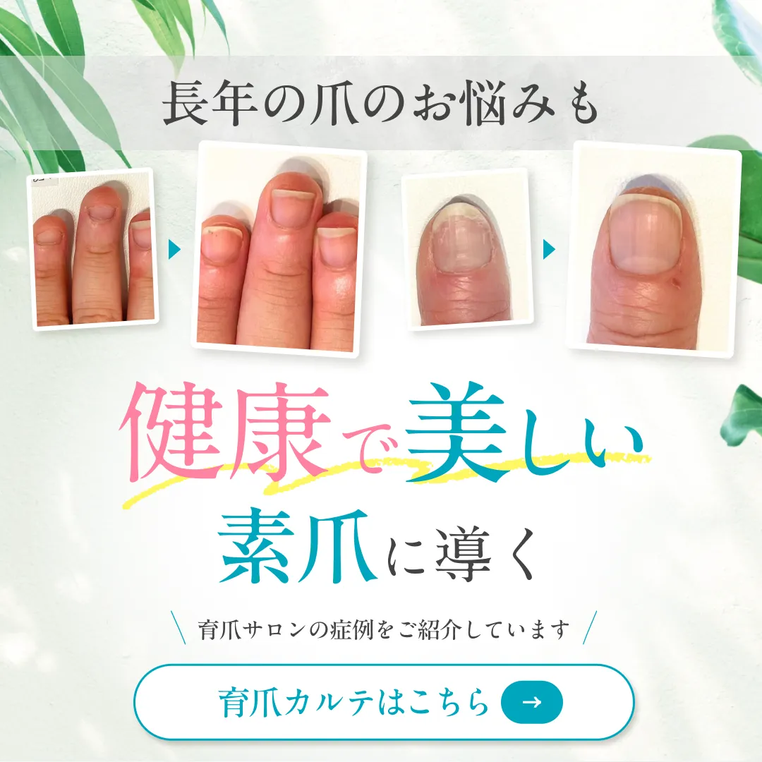 長年の爪のお悩みも健康で美しい素爪に導く。育爪カルテはこちら