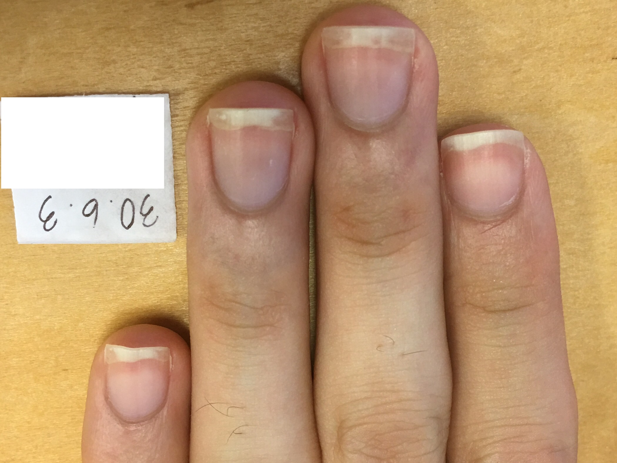 爪のピンク部分を大きくしたい 育爪 素のままで美しい爪へ