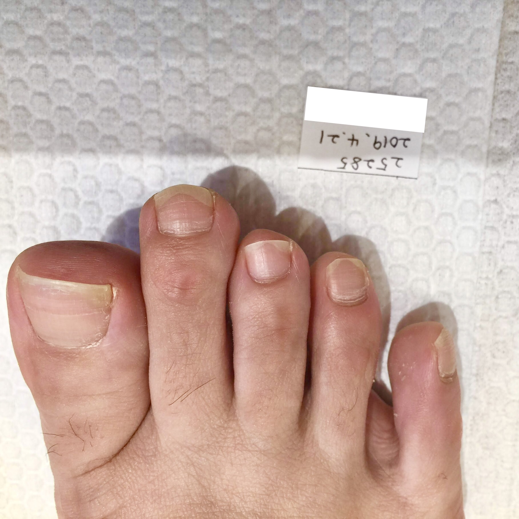 足の爪のピンクの部分が大きくなりました 育爪サロン ラメリック