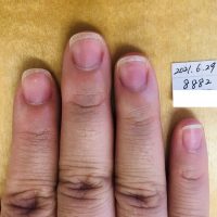 41日間でピンクが縦長に伸びました 育爪 素のままで美しい爪へ